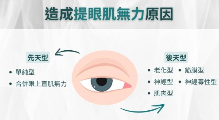 眼肌無力原因