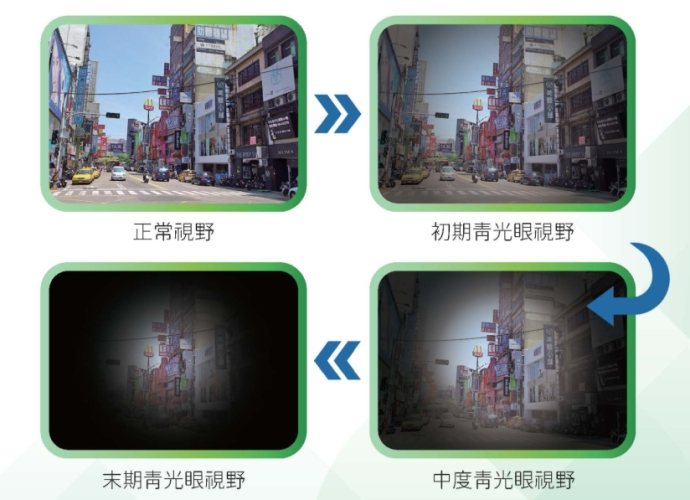 如何预防青光眼
