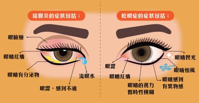 鞏膜炎治療