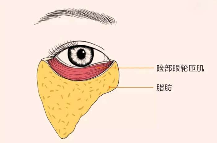 眼輪匝肌萎縮
