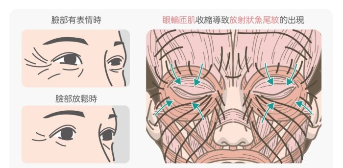 眼輪匝肌