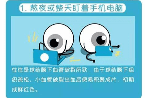 眼睛血絲原因有哪些 眼睛血絲原因有哪些