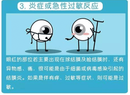 眼睛血絲症狀