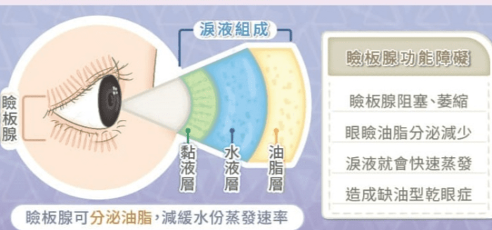 眼睛乾澀原因