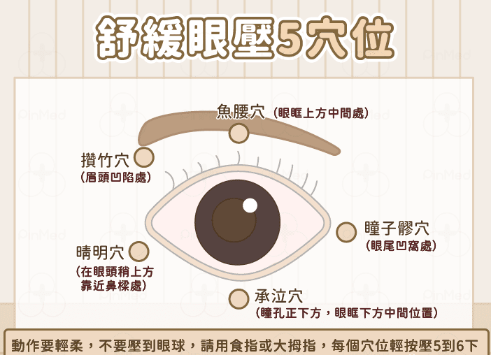 高眼壓症該如何預防