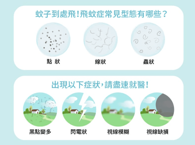 飛蚊症治療方式