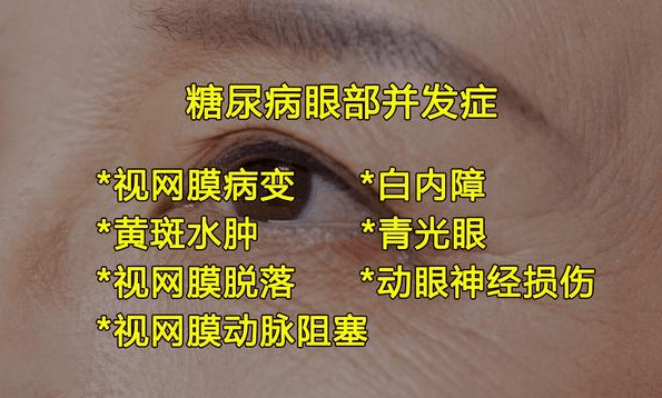 糖尿病眼睛疾病表現