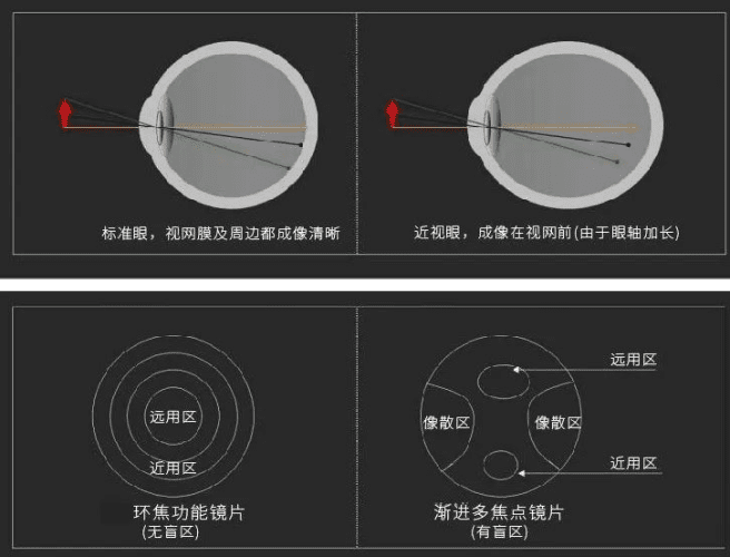 眼睛失焦原因