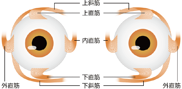 斜視的成因