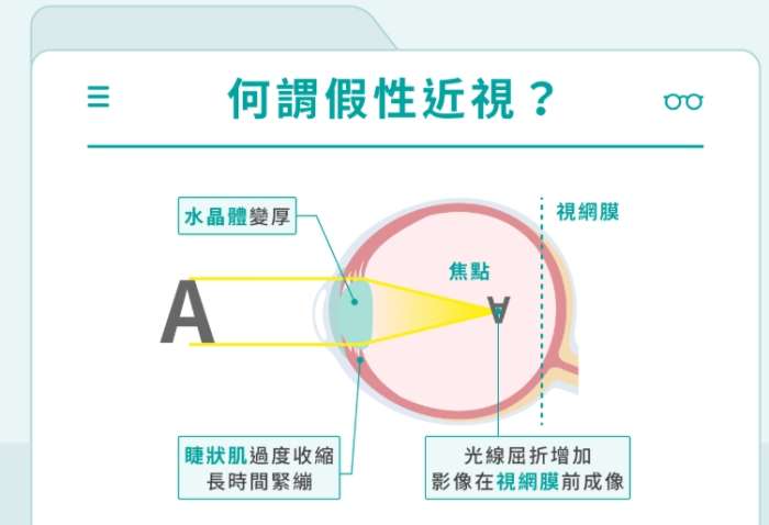 假性近視治療